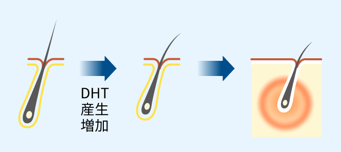 DHTの産生増加