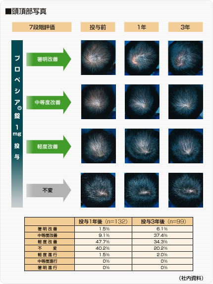 プロペシア錠1mgを投与した頭頂部の写真