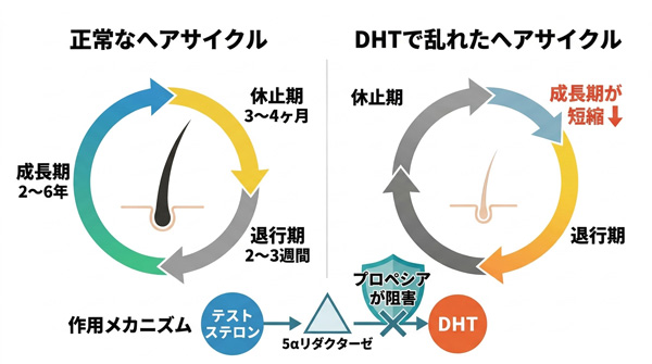 プロペシアの作用機序。正常なヘアサイクルとDHTで成長期が短縮されたヘアサイクルの比較図