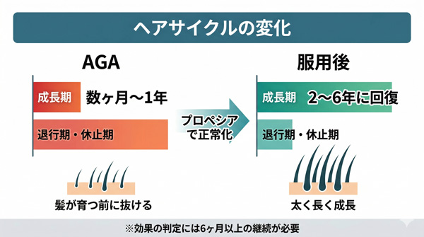 AGAで数ヶ月〜1年に短縮された成長期が、プロペシア服用後に2〜6年へ回復するヘアサイクルの変化。効果判定には6ヶ月以上の継続が必要